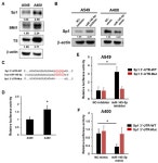 miR-145-5p Targets Sp1 in Non-Small Cell Lung Cancer Cells and Links to BMI1 Induced Pemetrexed Resistance and Epithelial... 