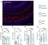 IJMS | Free Full-Text | Conditional Ablation of Glucocorticoid and Mineralocorticoid Receptors from Cochlear Supporting Cells... 