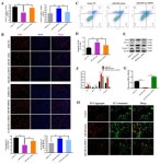 IJMS | Free Full-Text | miR-486 Responds to Apoptosis and... miR-486 Responds to Apoptosis and Autophagy by Repressing SRSF3... 