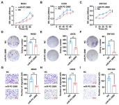 MicroRNA PC-3p-2869 Regulates Antler Growth and Inhibits Proliferation and Migration of Human Osteosarcoma and Chondrosarcoma... 