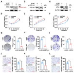 MicroRNA PC-3p-2869 Regulates Antler Growth and Inhibits Proliferation and Migration of Human Osteosarcoma and Chondrosarcoma... 
