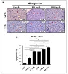 IJMS | Free Full-Text | Prenatal High-Fat Diet Combined with Microplastic Exposure Induces Liver Injury via Oxidative Stress in... 