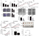 Activation of the G Protein-Coupled Bile Acid Receptor TGR5 Modulates the HCP5/miR-139-5p/DDIT4 Axis to Antagonize Cervical... 