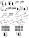 HCP5/miR-139-5p/DDIT4 Axis to Antagonize Cervical Cancer... the HCP5/miR-139-5p/DDIT4 Axis to Antagonize Cervical Cancer Progression