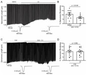 Activation of G Protein-Coupled Estrogen Receptor (GPER) Negatively Modulates Cardiac Excitation&ndash;Contraction Coupling (ECC)... 