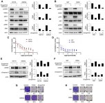 Zongertinib, a Novel HER2 Tyrosine Kinase Inhibitor, Maintains an Anticancer Activity for Trastuzumab Deruxtecan-Resistant... 