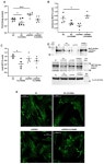 GPR81 Regulates MCT1 Membrane Translocation Through a PKA-Dependent Signaling Pathway in Rat Podocytes