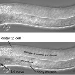 Figure 22, In a moderately left view, the posterior arm of an L4 gonad is prominent - WormBook - NCBI Bookshelf