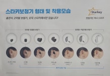 스타키보청기 왜관점