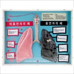 생활건강 의료기기 쇼핑몰 오픈메디칼 오픈메디칼