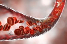 News From the World of Medicine | Readers Digest