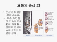 요통에 대하여