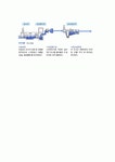 물리적 처리(하수처리)