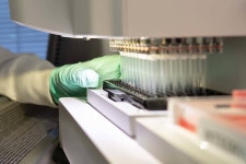 FDA approves Alzheimer’s drug panned by experts | Health | Life FDA approves debated Alzheimer’s drug panned by experts