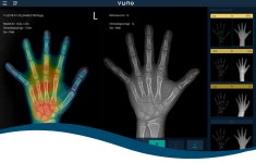 [(주)뷰노] 2019 부문별 공개채용(머신러닝,SW개발 외) - 사람인