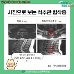 서대문구청 > 구정소식 > 새소식 > 공지사항 | [움직임이 즐거운 서대문구 11월호] 건강 운동 정보 보기