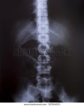 X-ray Image Human Medical Diagnosis 스톡 사진 183066815 | Shutterstock