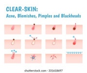 모든공사의정석모공 | 49,805개의 모공 케어 이미지, 스톡 사진, 3D 오브젝트, 벡터 | Shutterstock