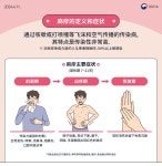 Sogang University [KOR/ENG/CHN] 홍역 지속 발생에 따른 외국인 유학생 대상 홍역 예방 및 관리