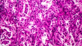 SMMT - 해외주식 마이너 갤러리