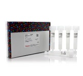 NAb™ Protein L Spin Columns, 1 mL