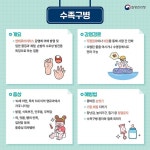손·발·입안 수포성 발진 일으키는 ‘수족구병’ 주의하세요