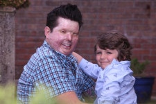 Acid victims delight as he has baby with the wife who stood by him after being horribly disfigured by thug in mistaken identity... 