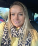 scalp after cyst turns out to be skin cancer | The Irish Sun Mum-of-three left with gaping crater on scalp after skin cancer battle
