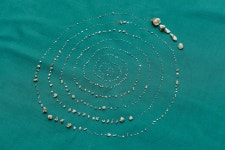 Doctors remove 526 teeth from seven-year-old boys mouth after... remove 526 teeth from seven-year-old boys mouth after he... 