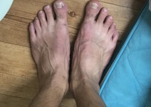 풋풋한발닥터아이엔티본오점 | 난 운동후 내 발을 찍음
