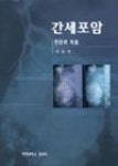 간세포암 | 영풍문고
