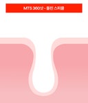 주식회사 니들워커 | 모공에 쏘는 40만니들샷! Y자모공 꽉 쪼여요 360º회전니들 MTS크림 by 주식회사 어댑트