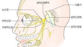 아츄증후군과 빛 재채기 반사의 원인, 증상, 예방법까지 ☀️ | 나에게 딱 맞는 건강 꿀팁
