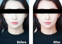 포토샵편집 외주: 인물, 제품, 식품, 건물 등 어떤 사진이든 고퀄리티로 리터칭해드립니다 크몽