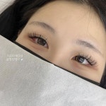 ⋆ ₊ ゚ 인중축소는 디프미에서 🫧 #인중축소 #인중성형 #강남입술문신