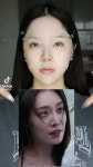 주식회사 한국안면성장교정센터 | ENG) HOW TO FIX FACIAL ASYMMETRY 안면 비대칭 교정법 ENG) HOW TO FIX FACIAL ASYMMETRY 안면 비대칭 교정법 | Quick workout...