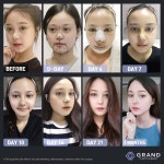 세아림피부미용 | 미용 | 웃긴 사진, 피부관리, 시술