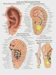 웰빙앤라이프 귀반사연구소 | Acupressure points in ears | 반사요법, 침술, 치유