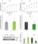 Auditory sensory deprivation induced by noise exposure exacerbates cognitive decline in a mouse model of Alzheimer’s disease...