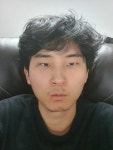 포모스 다이아 노방종 끝난 후 김민교 얼굴 상황 다이아 노방종 끝난 후 김민교 얼굴 상황