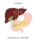 308 Fat transplant 이미지, 스톡 사진 및 벡터 | Shutterstock