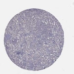 Tissue expression of NPTX2 - Staining in spleen - The Human Protein Atlas