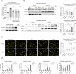 Co-inhibition of ATM and ROCK synergistically improves cell proliferation in replicative senescence by activating FOXM1 and E2F1...
