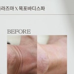 목포스킨플래닝 | #목포바디스파 #룩서스플라즈마 #입점할인기념 #목포피부관리 #피부관리 #태그아웃 ➡️피부에 달랑거리는 것 제거...
