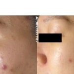 하이얀스킨앤바디(skin&body) | 덕분이에요.너무 뿌듯한..🤍저희야말로 믿고 찾아주심에 감사드려요 🙏#스킨앤바디아라@ara.skin_body#광주피부관리 #광주여드름...