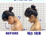 생리통도 굉장히 심하며, 생리기간에는 생리가 덩어리 형태로 끈적하게 나오며, 소화도 늘 안되고, 변도 늘 과민성 대장증후군처럼 하루에 여러번...