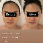 뷰티플랙스 내서점 | 셀리프팅&펌플랙스 조합💘📍효과 -이중턱 -#작은얼굴 -리프팅 -비대칭교정 -피부재생4월 뷰티 베네핏으로 1회 체험 받아보세요...