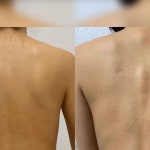 하면서 근막이완을 많이 진행하였으며, 특히... 잘록해지는 효과를 봤습니다.... | Instagram Instagram의 아산탕정 체형교정운동 전문센터 -SNPE프...