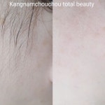 강남슈슈(kangnamchouchou) | 동춘동속눈썹동춘동왁싱동춘동피부관리강남슈슈토탈뷰티 | #구렛나루왁싱#볼왁싱#얼굴왁싱#왁싱스타그램 #왁싱잘하는곳#연수구왁싱...
