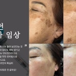 노탈리앤도담코스메틱 | 레이저 노탈리 히알펜 라멜타 바디기기 피부교육 | #노탈리... 사용해보세요 ^^⠀⠀⠀⠀⠀⠀#커스텀코스메틱 #피부교육 #기기교육...